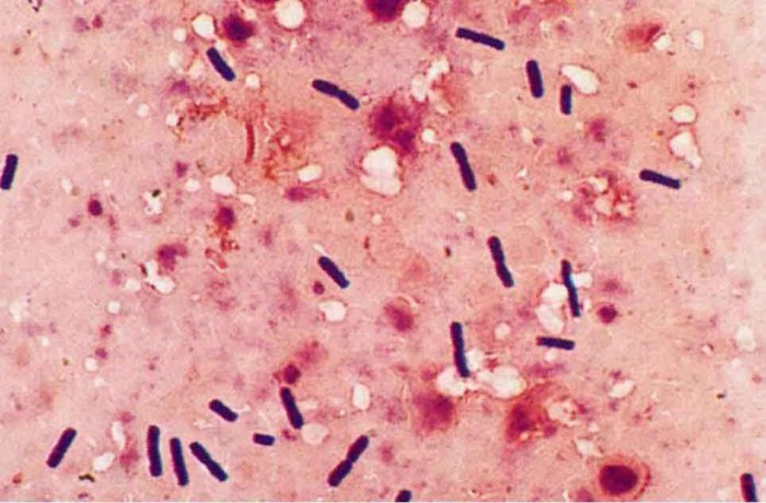 Bacteroides nodosus